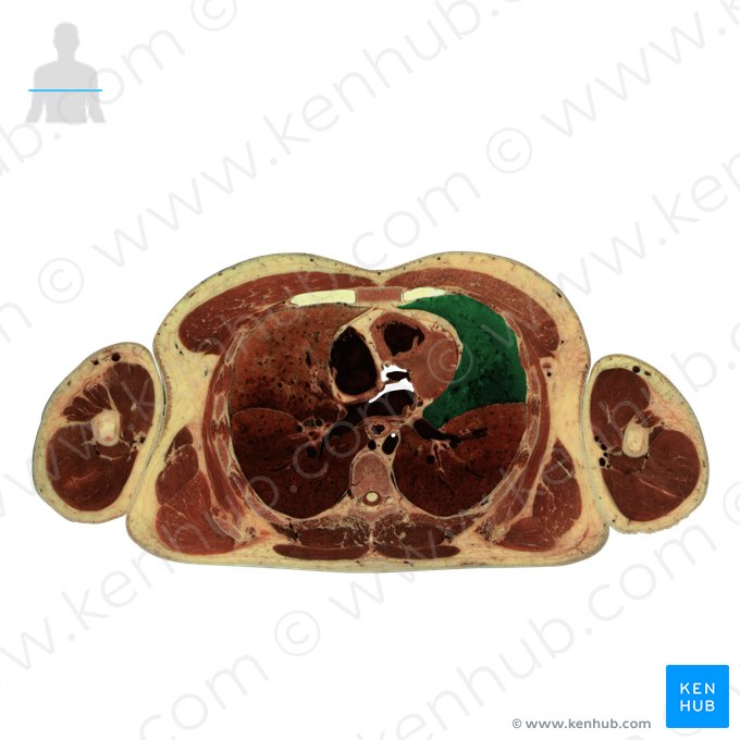 Superior lobe of left lung (Lobus superior pulmonis sinistri); Image: National Library of Medicine