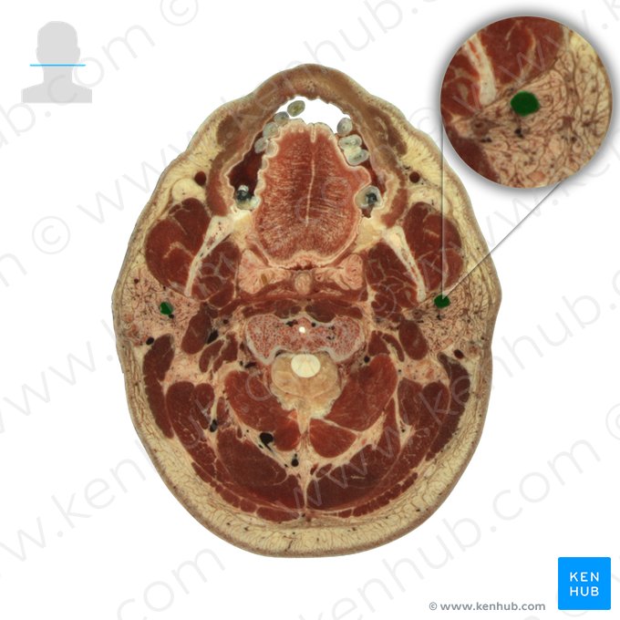 Veia retromandibular (Vena retromandibularis); Imagem: National Library of Medicine