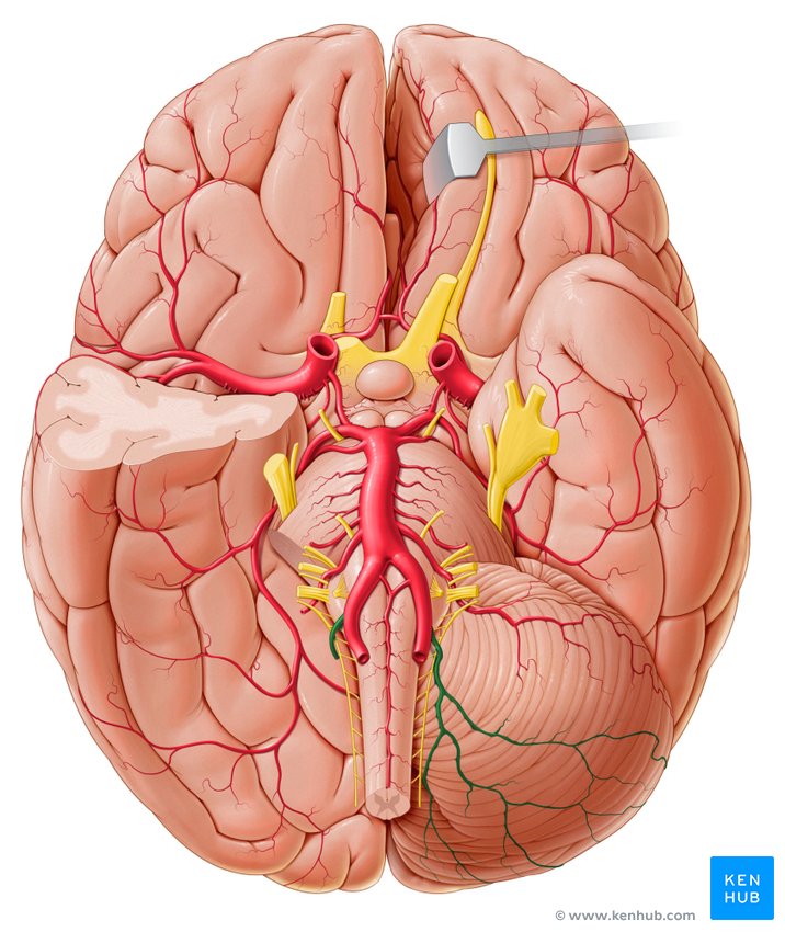 Posterior inferior cerebellar artery - caudal view