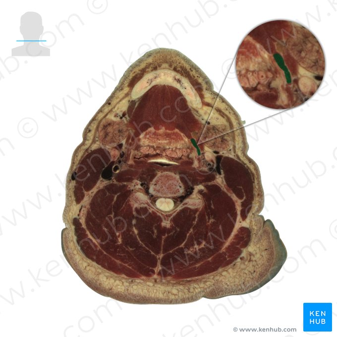 Musculus stylohyoideus (Griffel-Zungenbein-Muskel); Bild: National Library of Medicine