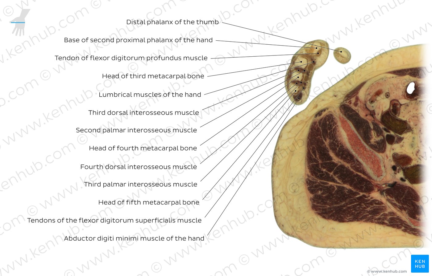 Metacarpophalangeal joints level: Overview