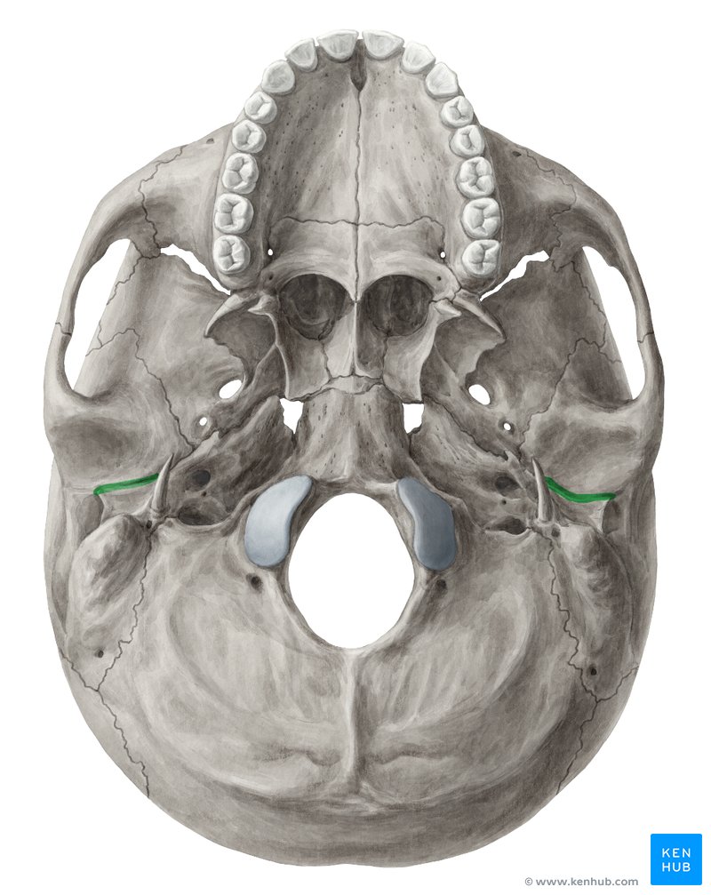 Petrotympanic fissure