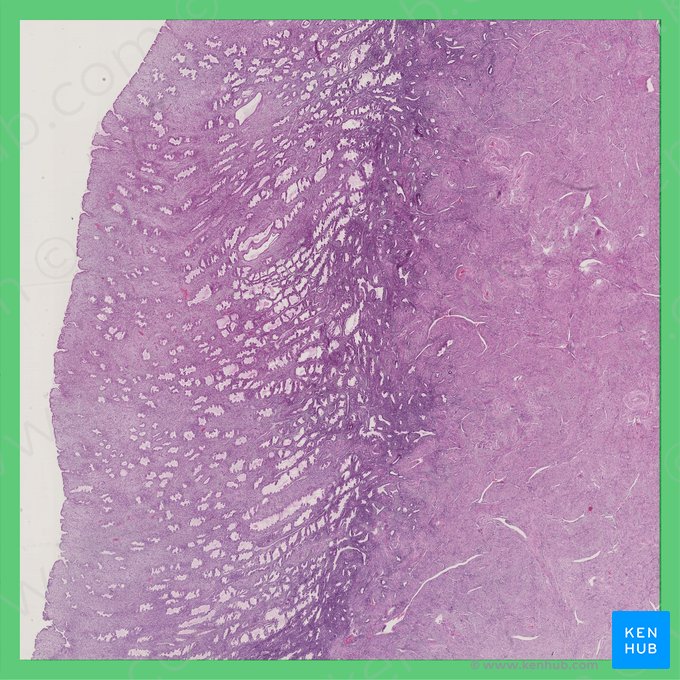 Fase secretora do útero (Phasis secretoria (Uterus)); Imagem: 
