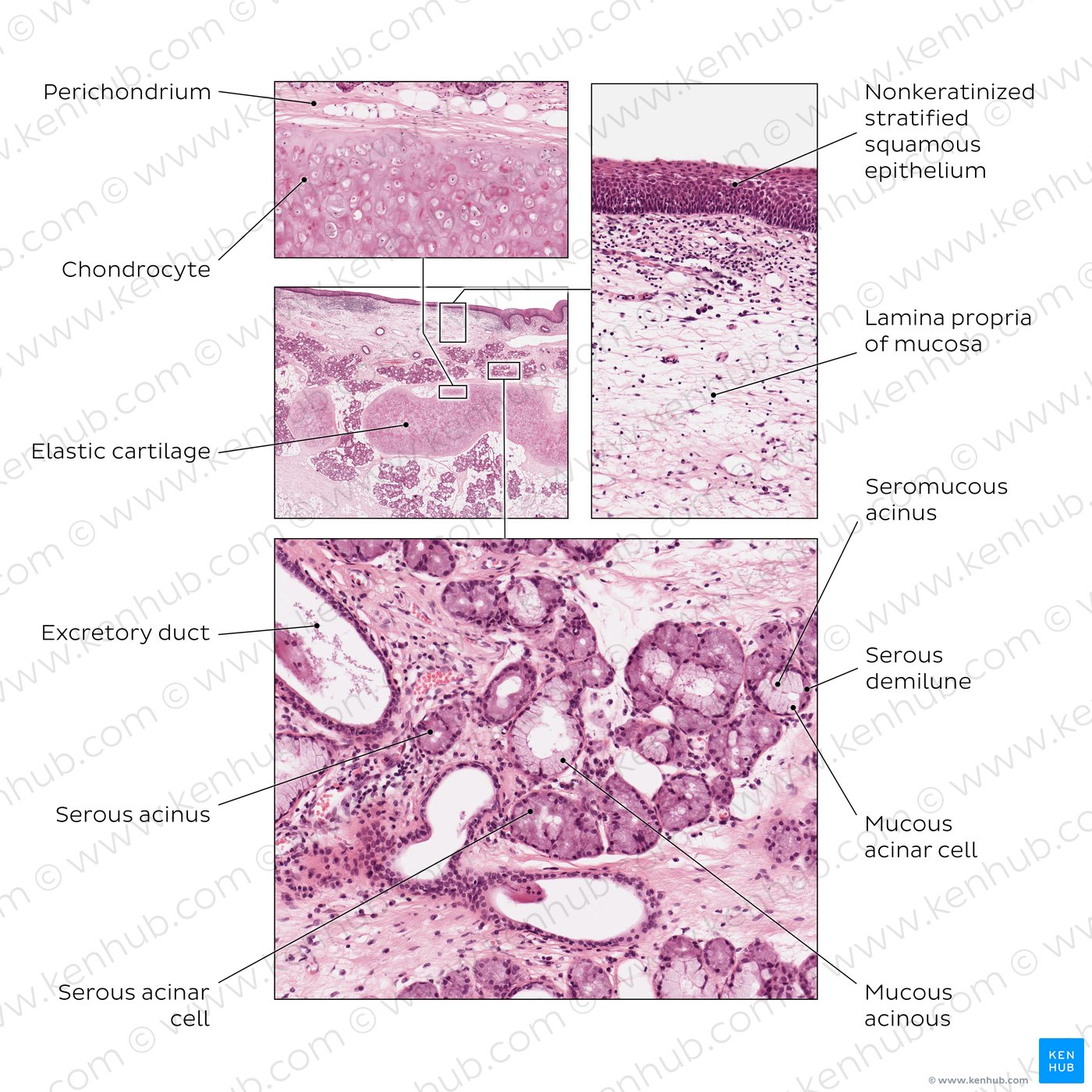 Epiglottis. HE stain.