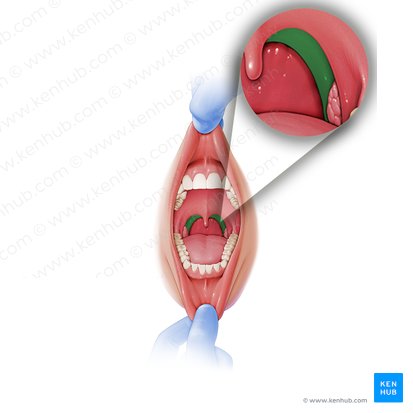 Palatopharyngeal arch (Arcus palatopharyngeus); Image: Paul Kim