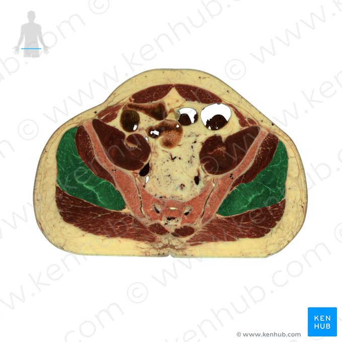 Musculus gluteus medius (Mittlerer Gesäßmuskel); Bild: National Library of Medicine