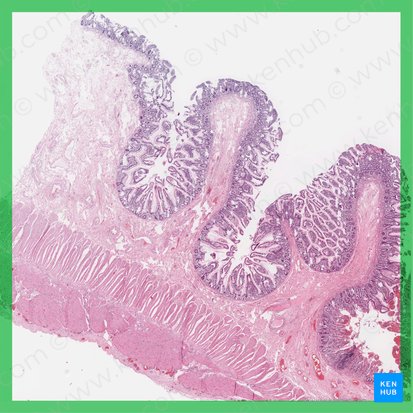 Jéjunum (Jejunum); Image : 