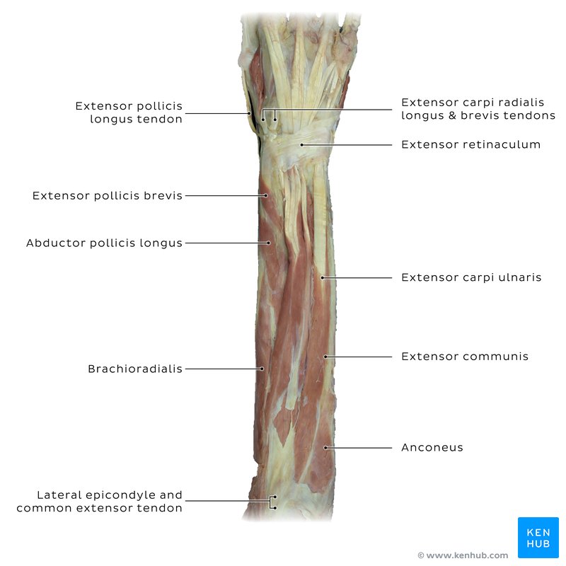 Anconeus muscle seen in the extensor compartment of the forearm muscles in a cadaver.