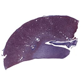 Riñón: Corteza, médula y pelvis renal