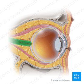 Optic nerve (Nervus opticus); Image: Paul Kim