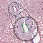 Ependymal cells