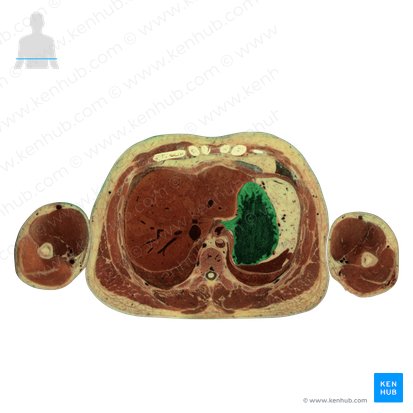 Stomach (Gaster); Image: National Library of Medicine