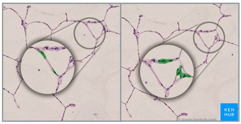 Cortes histológicos que ilustran los neumocitos tipo I (izquierda) y los pnemocitos tipo II (derecha)