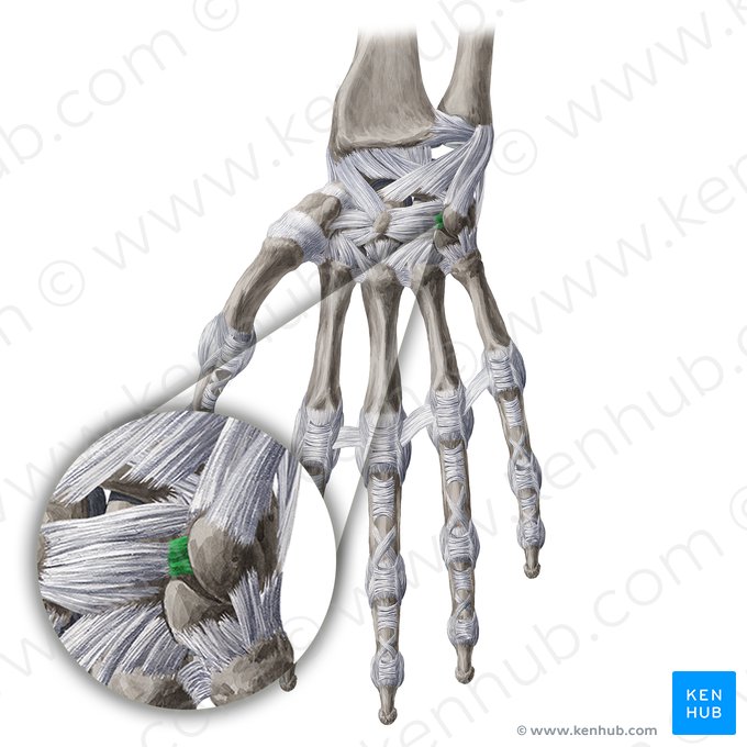 Ligamento piramidal-hamato palmar (Ligamentum triquetrohamatum palmare); Imagem: Yousun Koh