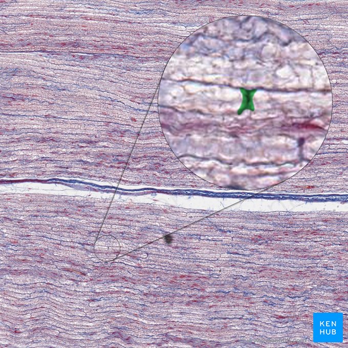 Node of Ranvier (Myelin sheath gap) (Nodus interruptionis myelini); Image: 