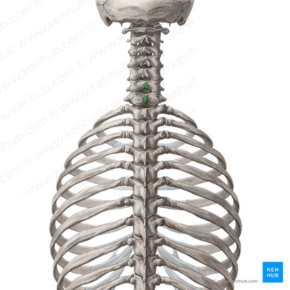 Spinous processes of vertebrae C6-C7 (Processus spinosi vertebrarum C6-C7); Image: Yousun Koh