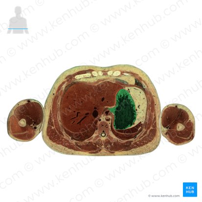 Estómago (Gaster); Imagen: National Library of Medicine