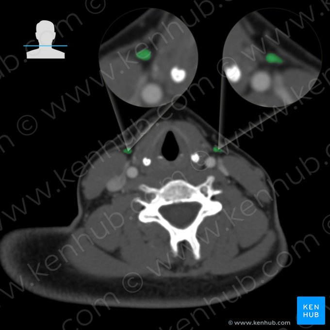 Anterior jugular vein (Vena jugularis anterior); Image: 