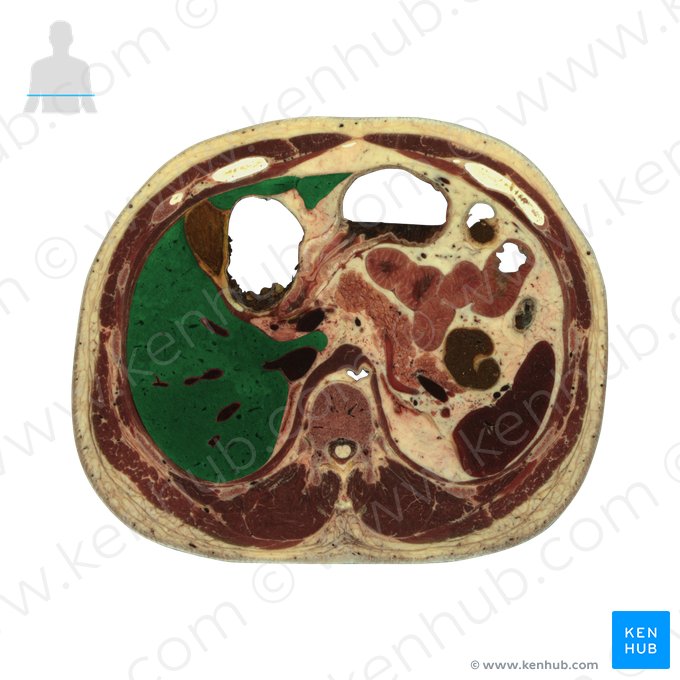 Fígado (Hepar); Imagem: National Library of Medicine