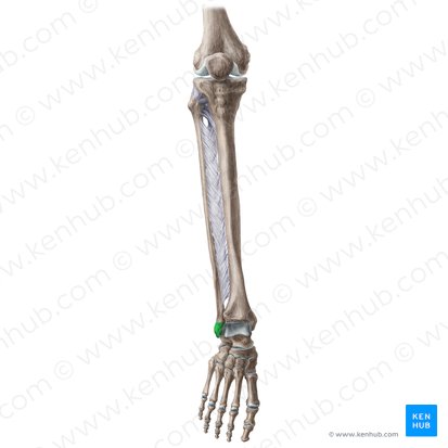 Maléolo lateral da fíbula (Malleolus lateralis fibulae); Imagem: Liene Znotina