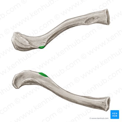 Tuberculum conoideum claviculae (Kegelförmiger Höcker des Schlüsselbeins); Bild: Samantha Zimmerman