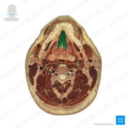 Genioglossus muscle (Musculus genioglossus); Image: National Library of Medicine