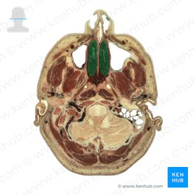Cornete nasal inferior (Concha nasalis inferior); Imagen: National Library of Medicine