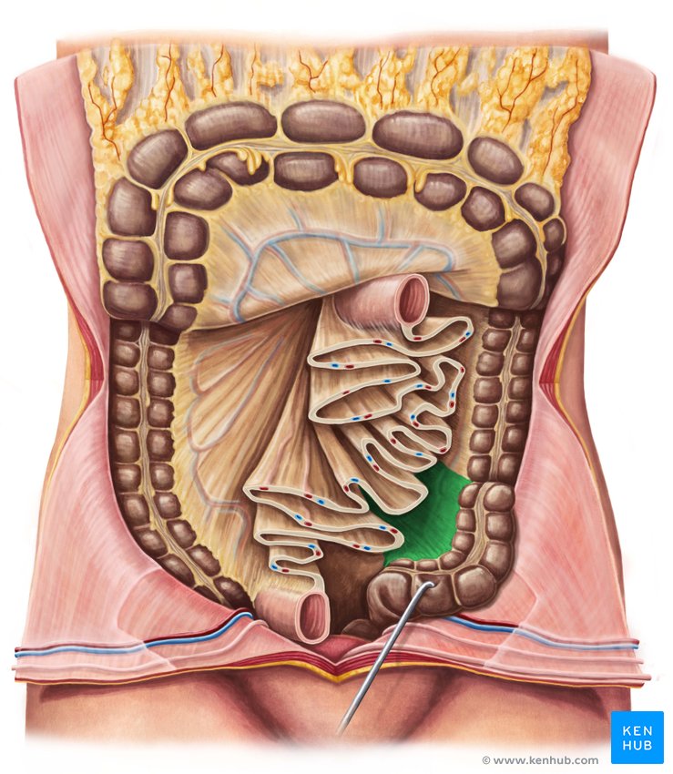 Sigmoid mesocolon - ventral view