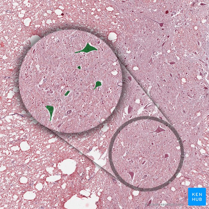 Cuerpo de la neurona motora (Soma motoneuri); Imagen: 