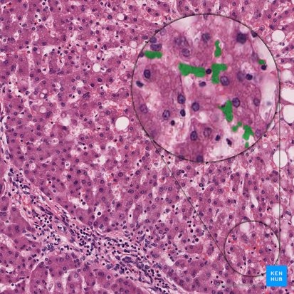 Erythrocyte (Erythrocytus); Image : 