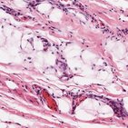 Loose connective tissue