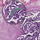 Central nervous system and brain lymphatics