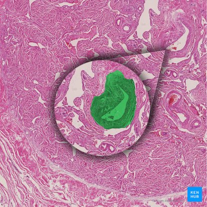 Arteria helicina del pene (Arteria helicina penis); Imagen: 