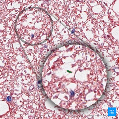 Cellule microgliale (Microgliocytus); Image : 