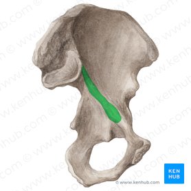 Arcuate line of ilium (Linea arcuata ossis ilii); Image: Liene Znotina