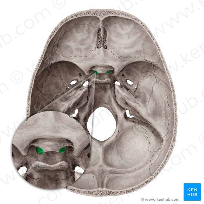 Processo clinoide médio (Processus clinoideus medius); Imagem: Yousun Koh