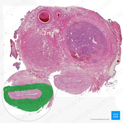 Cuerpo esponjoso del pene (Corpus spongiosum penis); Imagen: 