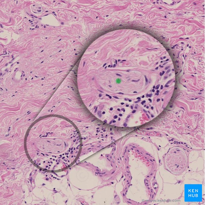 Neurofibrae (Nervenfasern); Bild: 