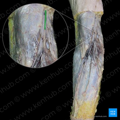 Medial antebrachial cutaneous nerve (Nervus cutaneus medialis antebrachii); Image: 