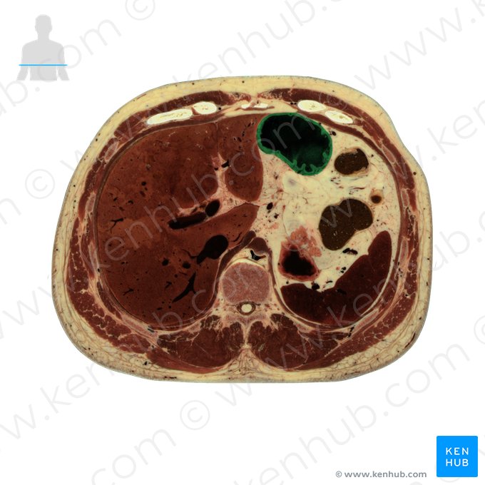 Porção pilórica do estômago (Pars pylorica gastris); Imagem: National Library of Medicine