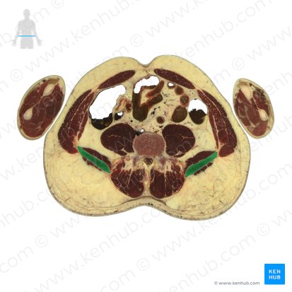 Ilion (Os ilium); Imagen: National Library of Medicine