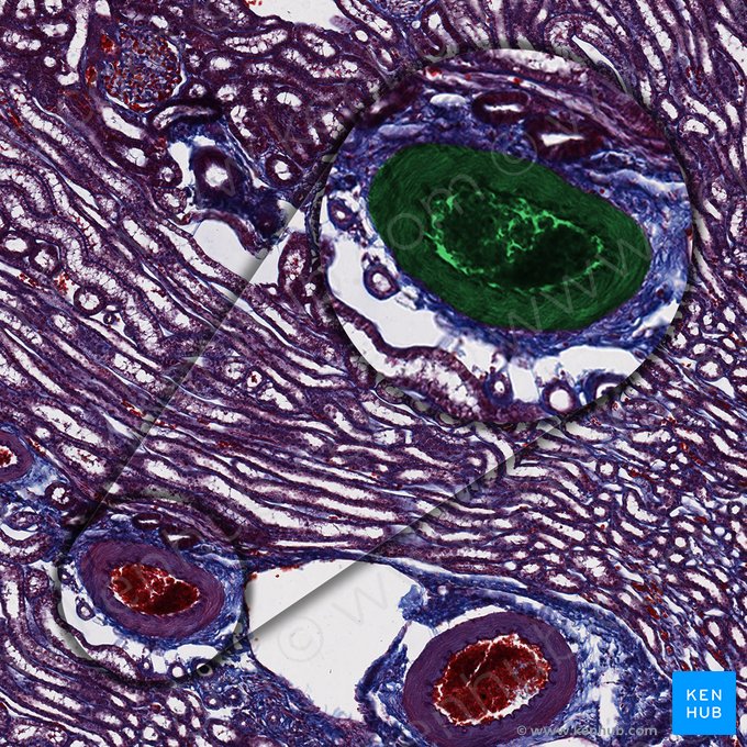 Artéria interlobular (Arteria interlobularis); Imagem: 