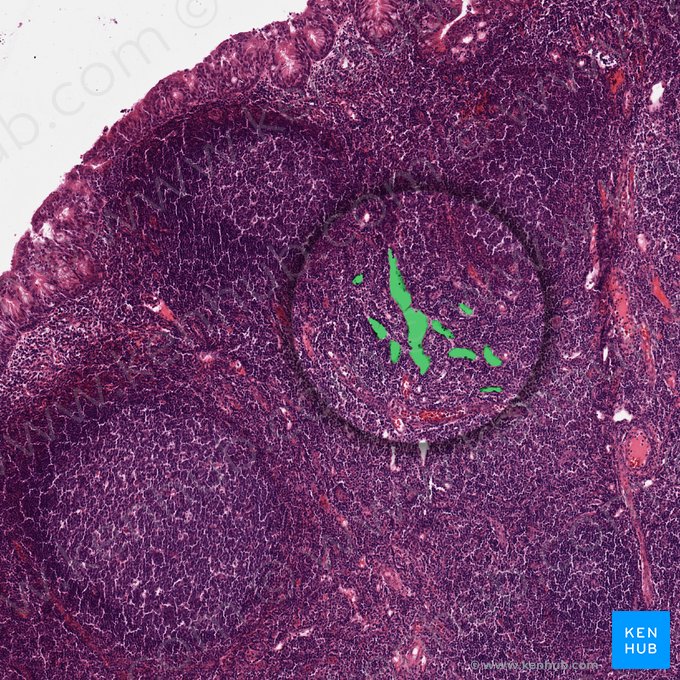 Vénula endotelial alta (Venula altoendothelialis); Imagen: 