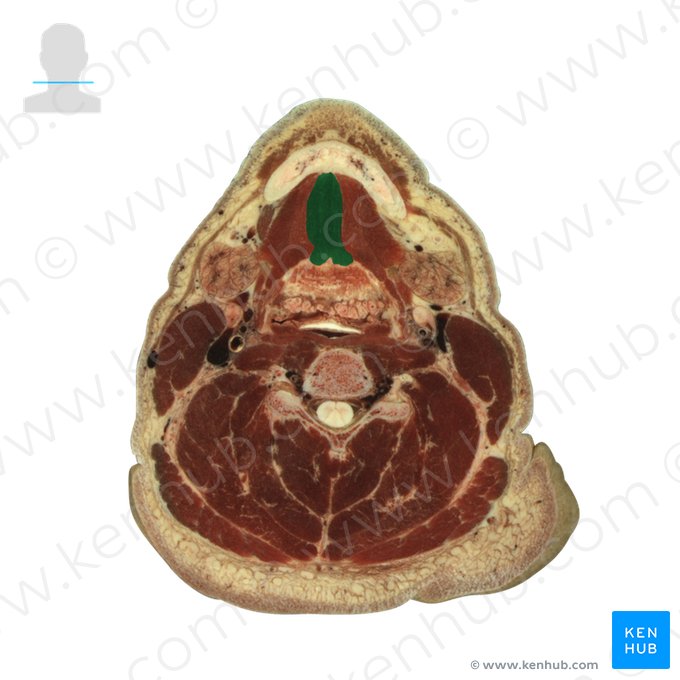 Genioglossus muscle (Musculus genioglossus); Image: National Library of Medicine
