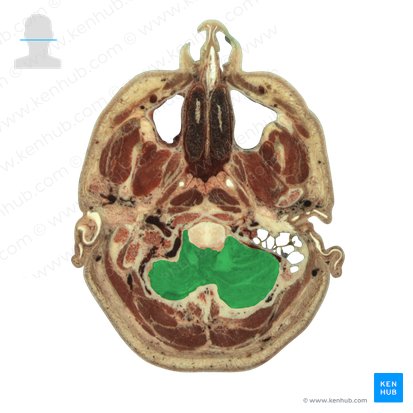 Cerebellum (Kleinhirn); Bild: National Library of Medicine