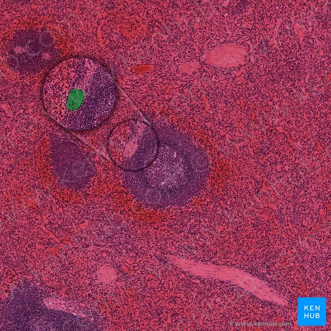 Central arteriole of spleen (Arteriola centralis splenis); Image: 