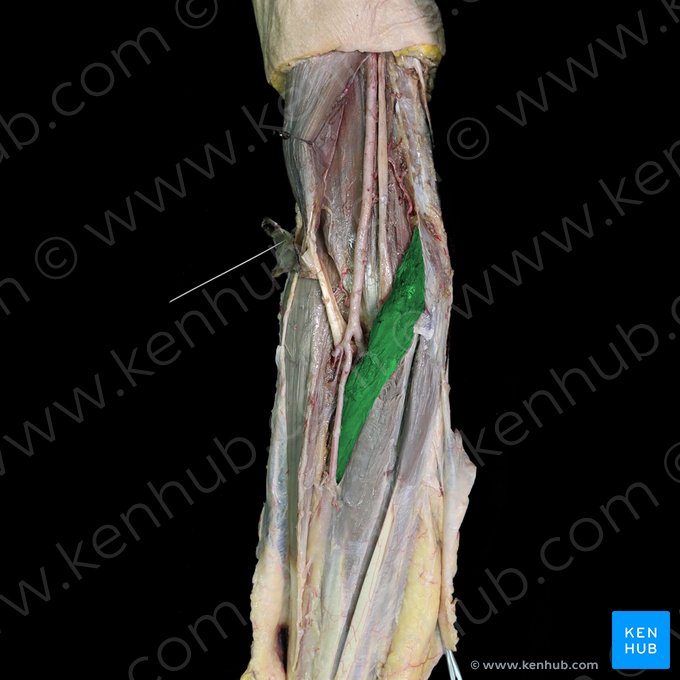 Musculus pronator teres (Runder Einwärtsdreher); Bild: 