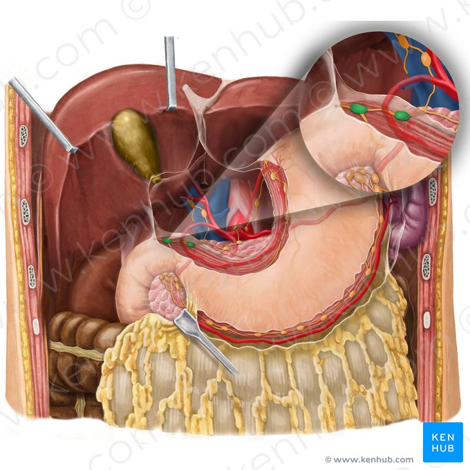 Nodi lymphoidei suprapylorici (Suprapylorische Lymphknoten); Bild: Begoña Rodriguez