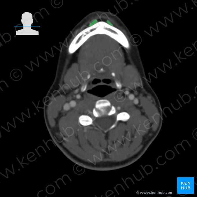 Mentalis muscle (Musculus mentalis); Image: 