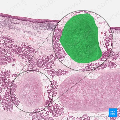 Elastic cartilage (Cartilago elastica); Image: 